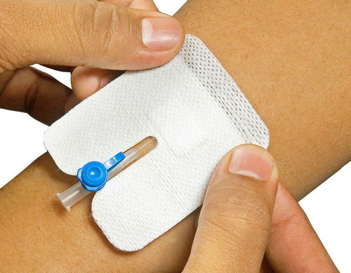 چسب آنژیوکت